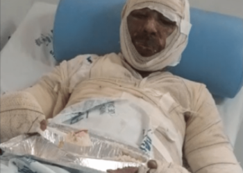 Com casa incendiada e proprietário queimado, família pede ajuda