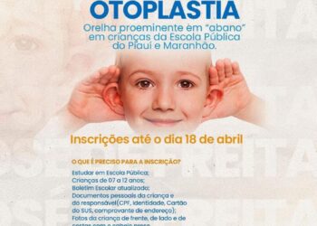 Fundação Erlade irá realiza mutirão de cirurgia de otoplastia em José de Freitas: