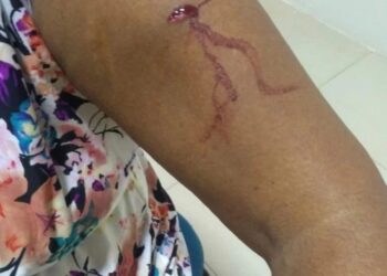 Homem tenta matar a própria companheira usando punhal em José de Freitas