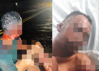 Homem é hospitalizado depois de ser atacado por vários cachorros, em Batalha